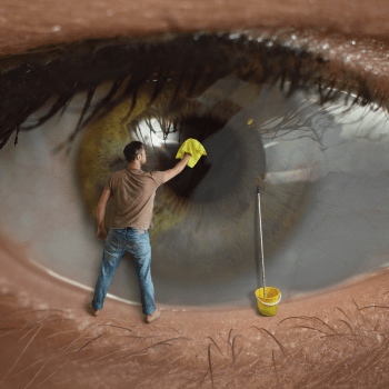Cataract: Types of Cataract Surgery, and Intraocular Lens