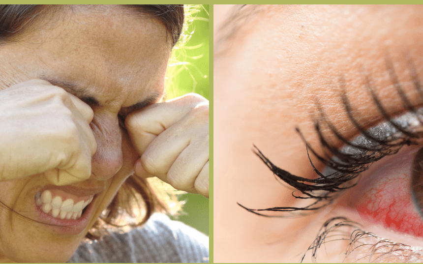 DRY EYE DISEASE