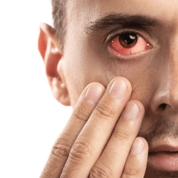 7 FACTS YOU NEED TO KNOW ABOUT CONJUNCTIVITIS