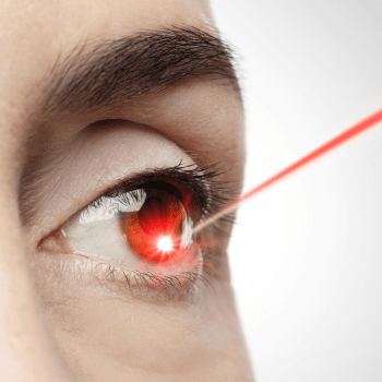 13 most frequently asked questions on LASIK