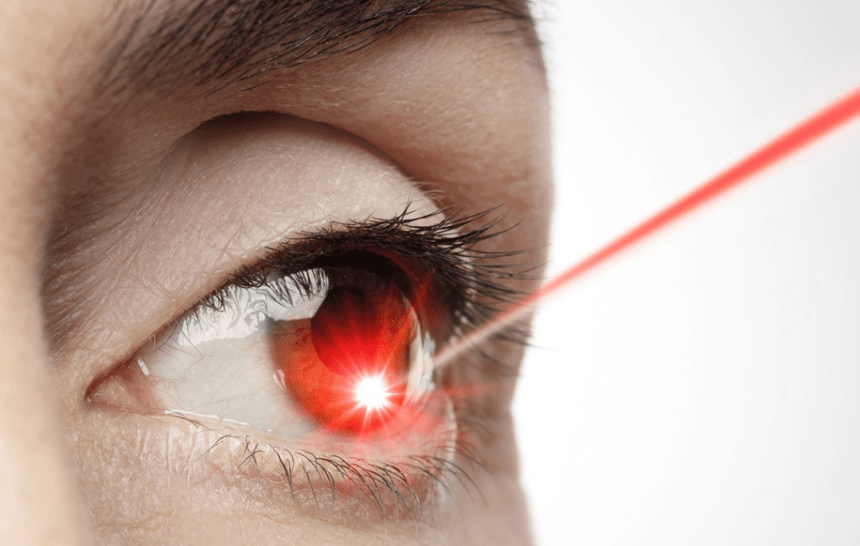 13 most frequently asked questions on LASIK