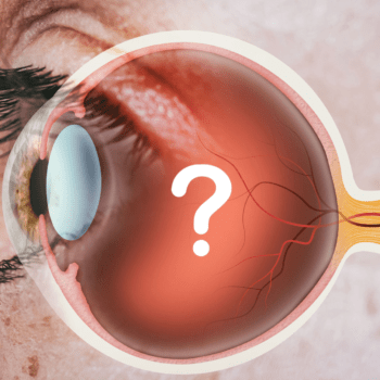 GLAUCOMA VS. CATARACT: UNDERSTANDING THE DIFFERENCES