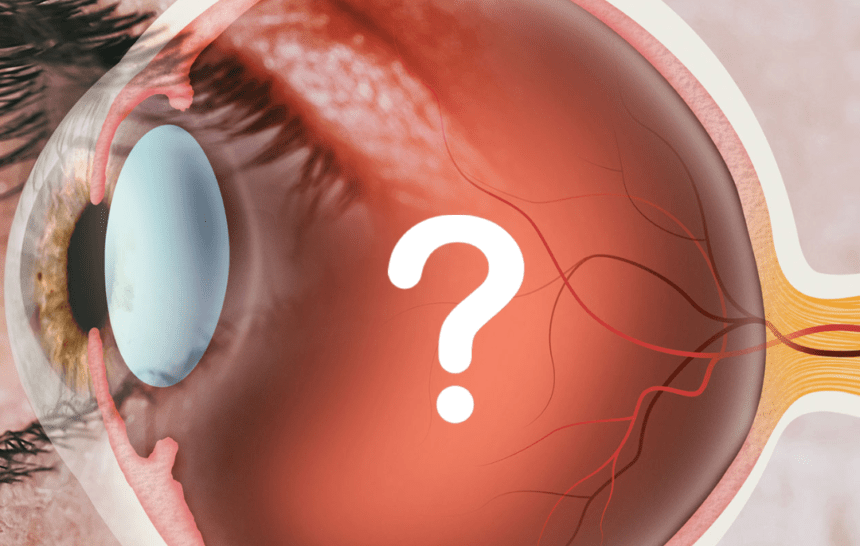 GLAUCOMA VS. CATARACT: UNDERSTANDING THE DIFFERENCES