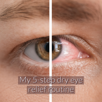 UNLOCKING THE SECRETS OF SOOTHING DRY EYES: MY 5 STEP ROUTINE